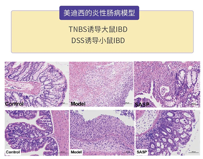 美迪西的炎性肠病模型.png