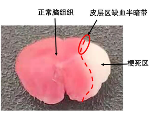 4-TCC染色法.jpg