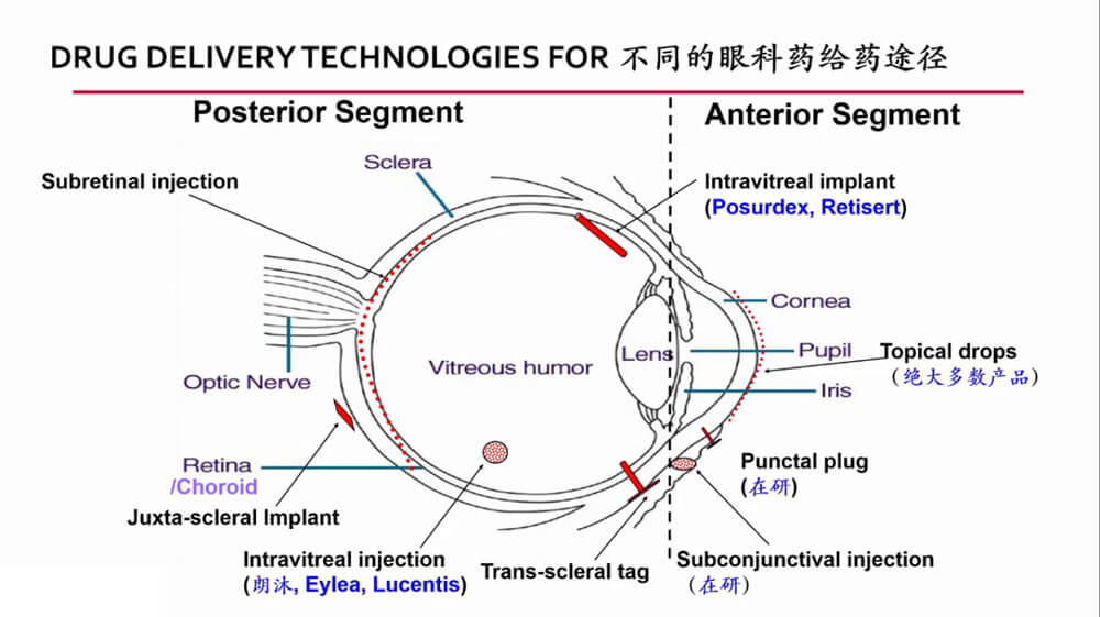 不同的眼科给药途径.jpg